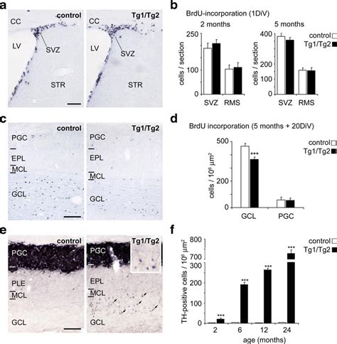 Impairment Of Neural Migration But Not Neurogenesis In The Svz And