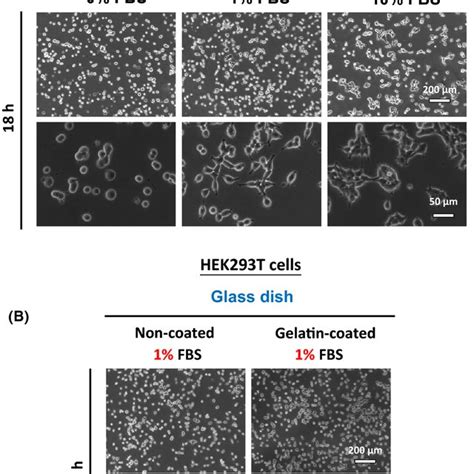 Effect Of FBS On The Adherent Property Of HEK293T Cells A HEK293T