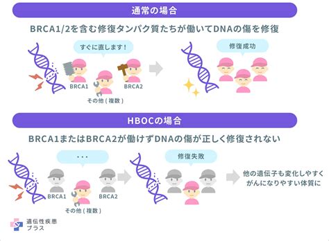 遺伝性乳がん卵巣がん 遺伝性疾患プラス