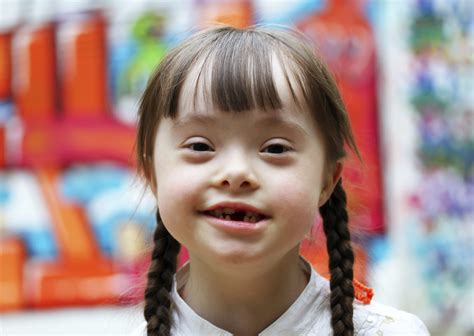 families cherish  child   syndrome cbs news