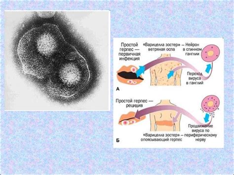 Вирус Герпеса. Семейство Herpesviridae - презентация онлайн