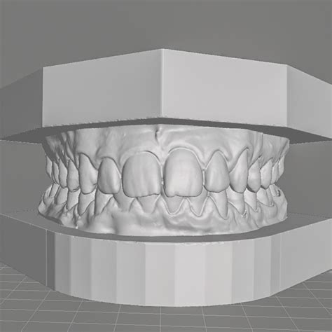 Fichier Stl Mod Le D Tude D Orthodontie Dentaire Avec Basesmod Le