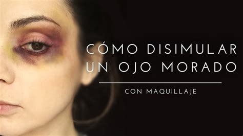 Como Quitar Un Moreton En El Ojo Rapido Consejos Ojos