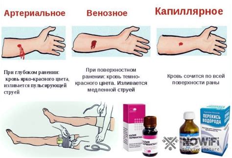 Кровоостанавливающие средства: лучшие способы и рекомендации
