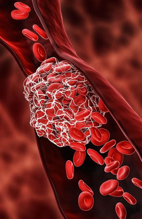 Vaccines Cut Risk Of Post Covid Heart Failure Blood Clots For At Least