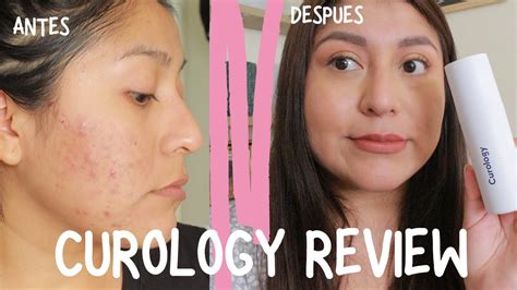 Reseña De Curology Mi Experiencia Costo Y Tips 😍🙌 2021 Youtube