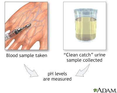 Urine pH test - UF Health