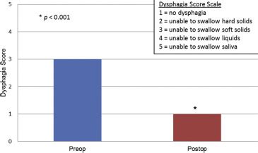 Thoracic Esophageal Diverticula A Year Experience Of Minimally