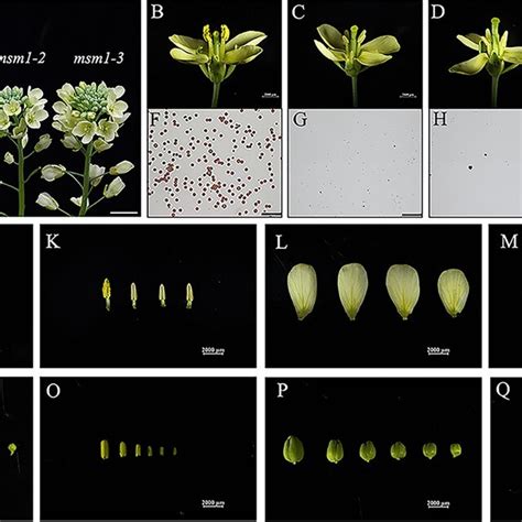 Morphology Comparison Among Wild Type ʻftʼ And Msm1 Mutants At The