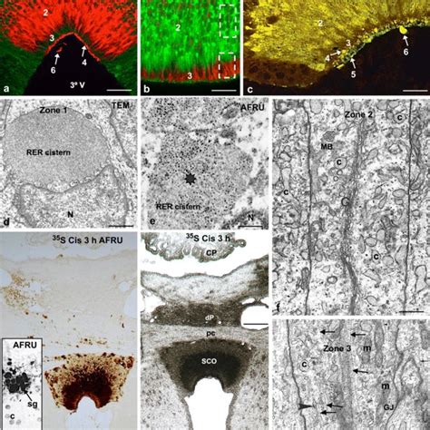 Xcge Lif Derived Fingerprints Of The Reissner Fiber N Glycosylation