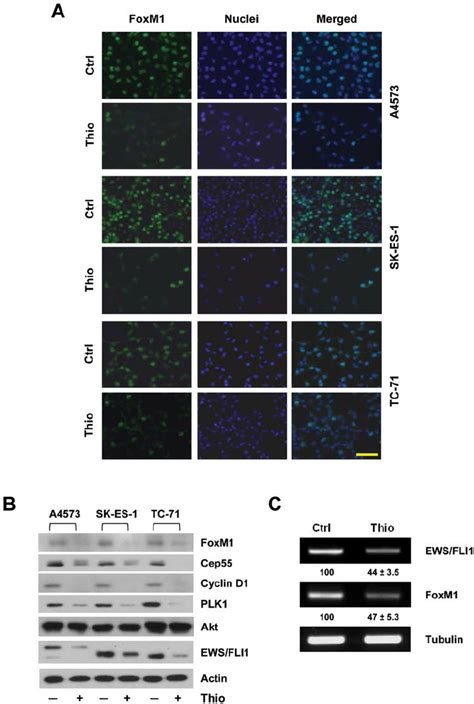 Thiostrepton Reduces Mrna And Protein Expression Of Foxm And Ews Fli