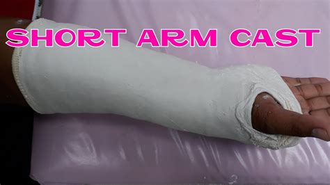 Short Arm Cast Byrakekrittanai Youtube