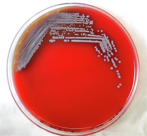 Burkholderia Pseudomallei Bacteria By Cdc Science Photo Library