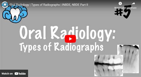 Oral Radiology | Types Of Radiographs | INBDE, NBDE Part II DenTubes