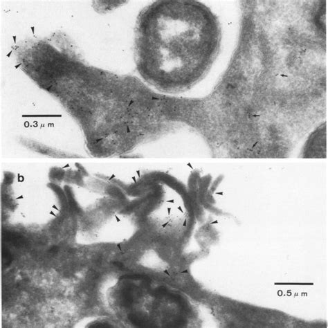 Transmission Electron Microscopy Of Shigella Flexneri Entry Into Hela