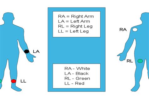 12 Lead Ecg Placement Color