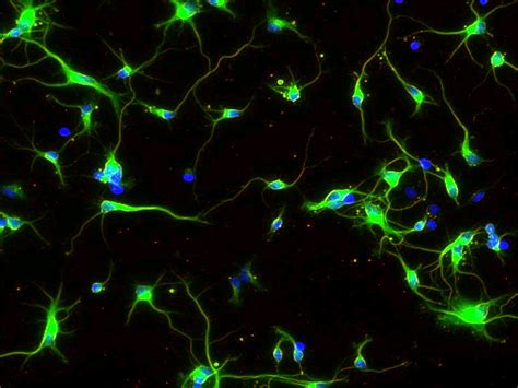 Rat Cortical Neurons Innoprot Brain Cell System Innoprofile