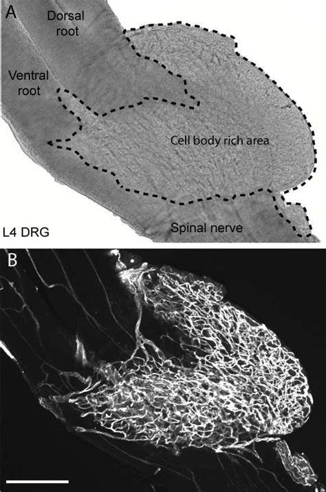 Mouse Dorsal Root Ganglion