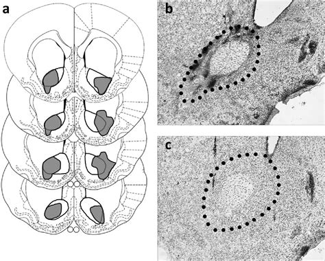 Figure 1 From Effects Of Nucleus Accumbens Core And Shell Lesions On