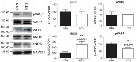 Nos1 Nos2 Nos3 Vasp And Pvasp Download Scientific Diagram