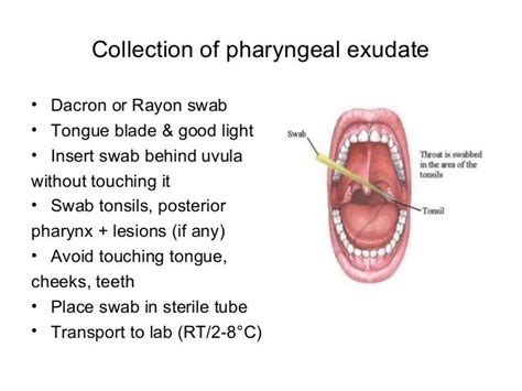 Laboratory diagnosis gram positive and gram negative cocci