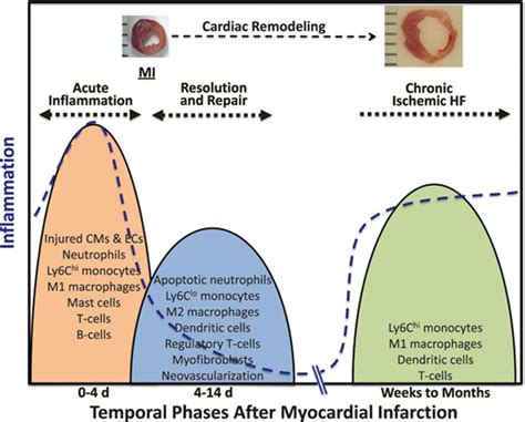 The Biological Basis For Cardiac Repair After Myocardial Infarction