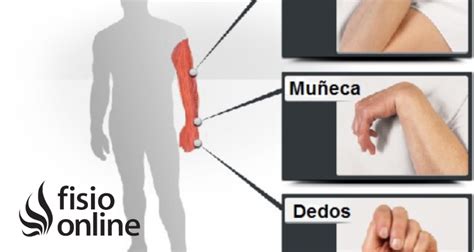 Espasticidad Qu Es Caracter Sticas En Qu Patolog As Aparece Por