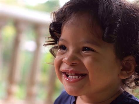 Cómo Es La Cirugía Innovadora Que Le Devuelve La Sonrisa A Los Niños Infobae