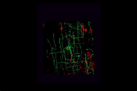 Nos Cerveaux Ont Volu Gr Ce Des Virus Brief Science