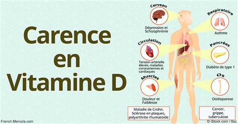 Signes Qui Peuvent T Moigner Dune Carence En Vitamine D