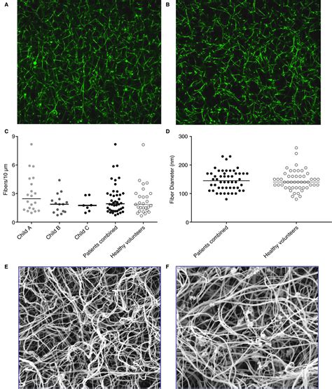 Procoagulant Changes In Fibrin Clot Structure In Patients With