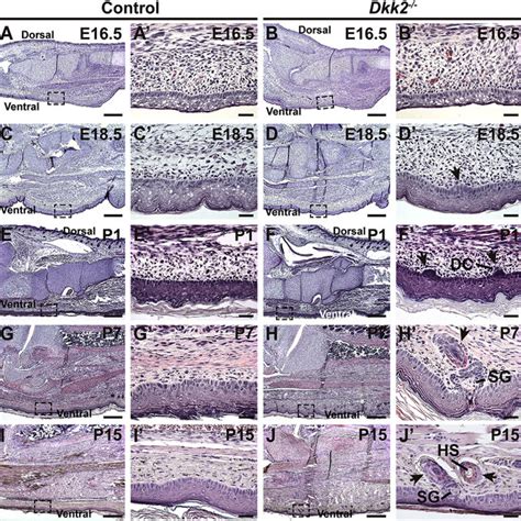 Ectopic Hair Follicle Placodes Form in Dkk2 À À Plantar Skin by E18 5