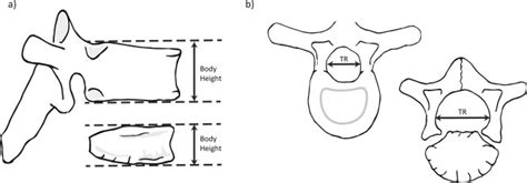 Measurements Of Vertebral Growth A Measurement Points Of Vertebral