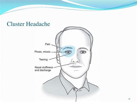 Ppt Headache Powerpoint Presentation Free Download Id 1936832