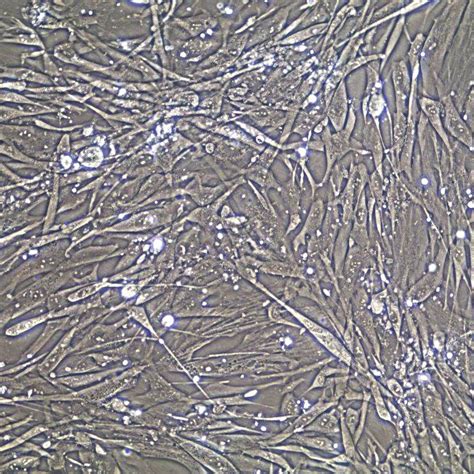 Hpasmc Human Pulmonary Artery Smooth Muscle Cellsystems®