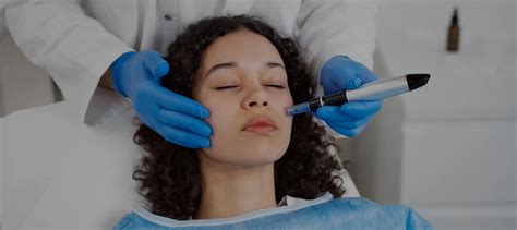 Microneedling Chicago Treat Acne Scars Wrinkles And More