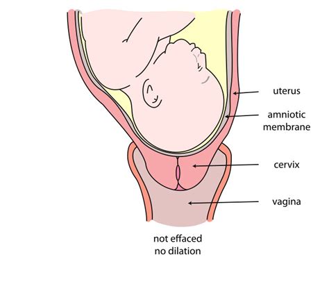 Cervix Dilation Chart Signs Stages And Procedure To Check 60 OFF