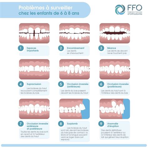 Orthodontie pour enfants à Nanterre 92 Faramarz Soheili