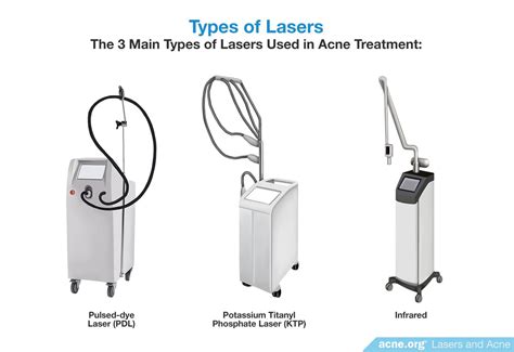 Do Lasers Work To Clear Acne