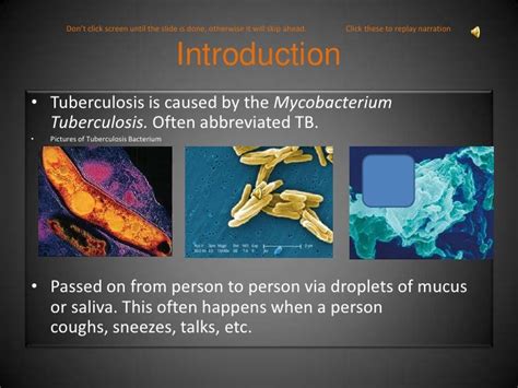 Causes Of Tuberculosis Powerpoint