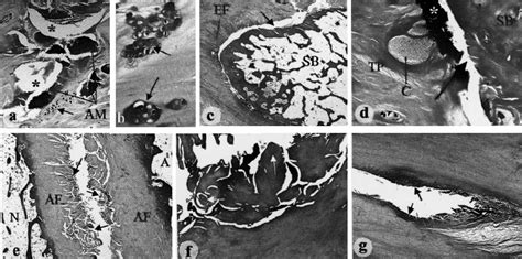 Histopathology of the enthesis organ of tibialis posterior. (a)... | Download Scientific Diagram