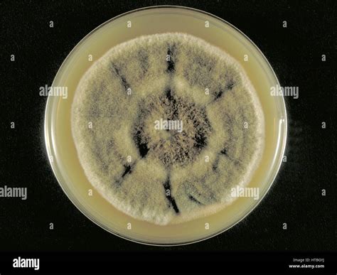 Sabouraud Dextrose Agar Fotograf As E Im Genes De Alta Resoluci N Alamy