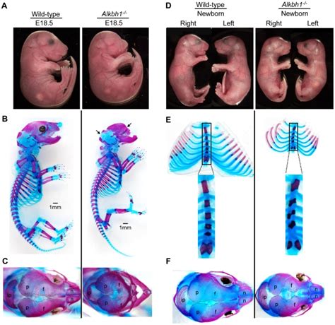 A Side View Of Embryos At E18 5 The Alkbh1 Has A Bilateral