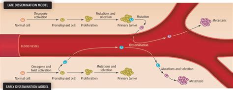 The Metastasis Cascade | Science