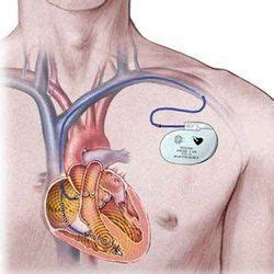 Pacemaker Surgery in India