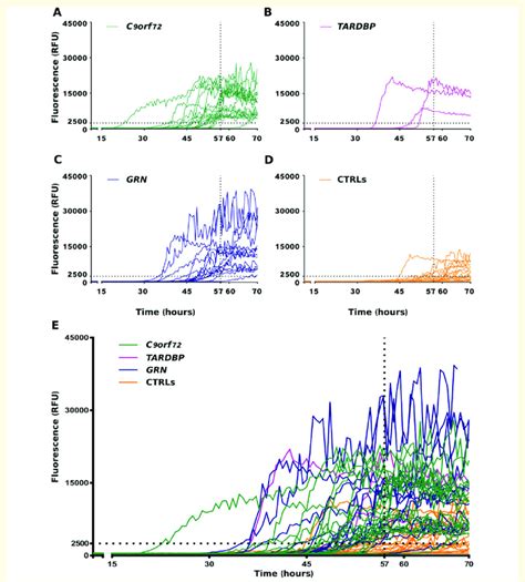 Rt Quic Analysis Of Als And Ftld Tdp Csf Samples In Brief 6 Ll Of