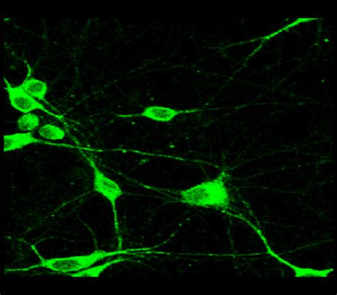 Mature Neuron Marker Antibody Panel IRAP5014 IReal Biotechnology Inc