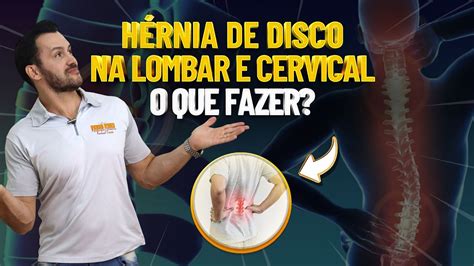 HÉRNIA DE DISCO NA LOMBAR E CERVICAL O QUE FAZER Fisioprev