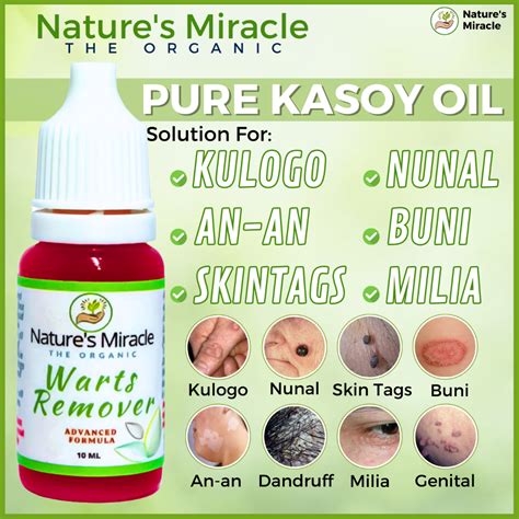 Warts Remover Original Kasoy Oil Kasoy Oil Wart Removal Original Kulugo