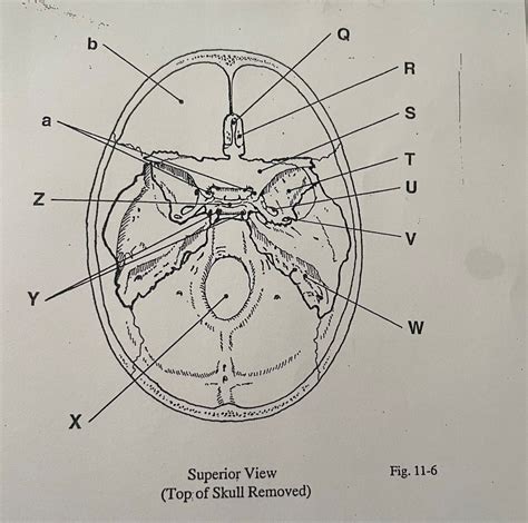 Top Of Skull Removed Labeling Diagram Quizlet